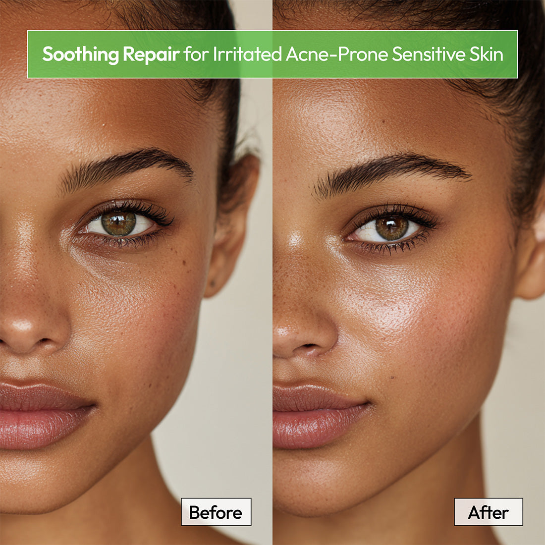 Soothing Daily Solution Niacinamide Cica Facial Mask Sheet (6 Masks)