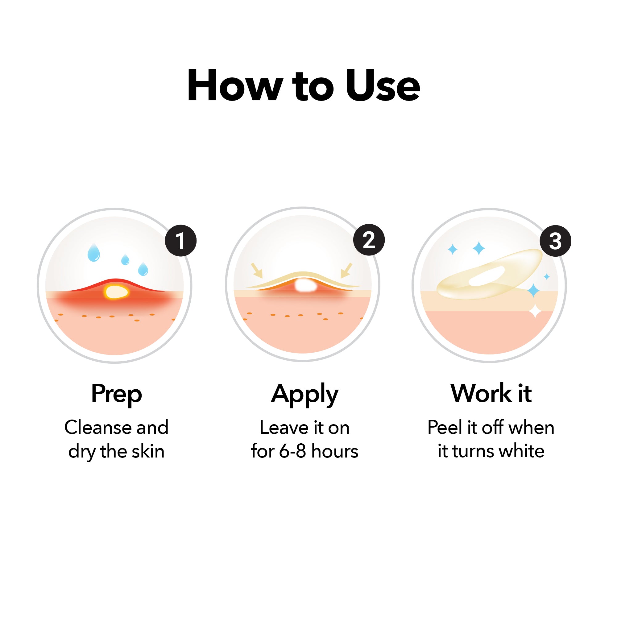 Surface+ Hydrocolloid Pimple & Pore Patch (10 Counts)