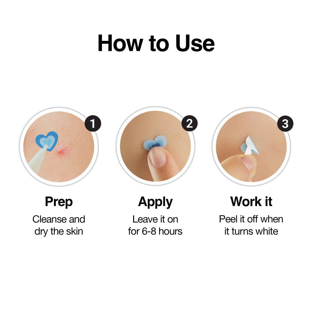 XOXO Hydrocolloid Pimple Patch (120 Counts)