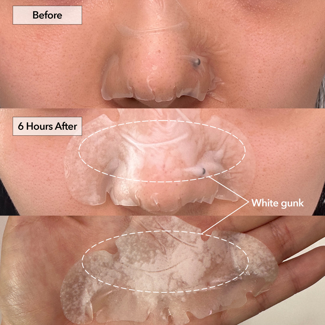 Nose+ Hydrocolloid Pimple & Pore Patch (10 Counts)