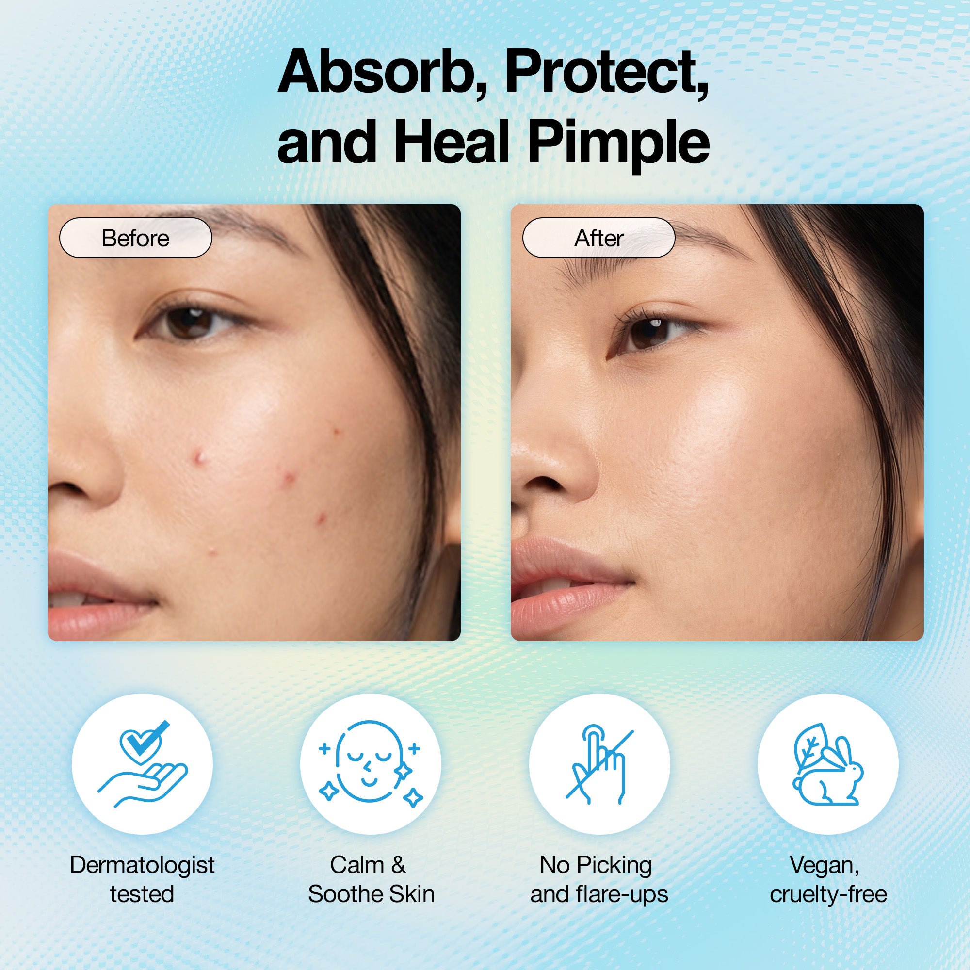 WOO JU Hydrocolloid Pimple Patch (120 Counts)