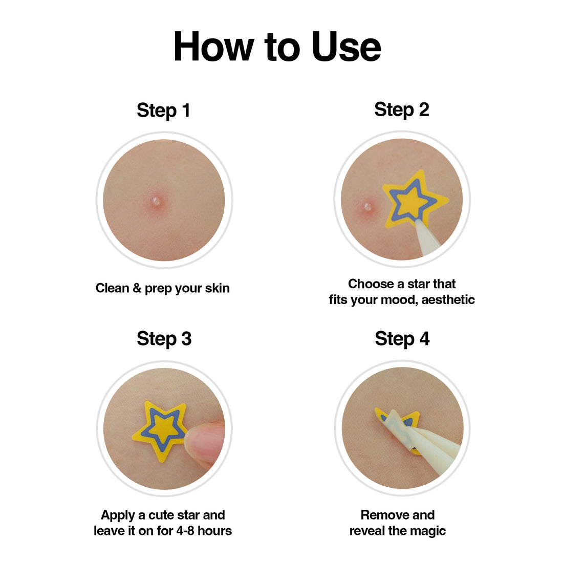 WOO JU Hydrocolloid Pimple Patch (120 Counts)