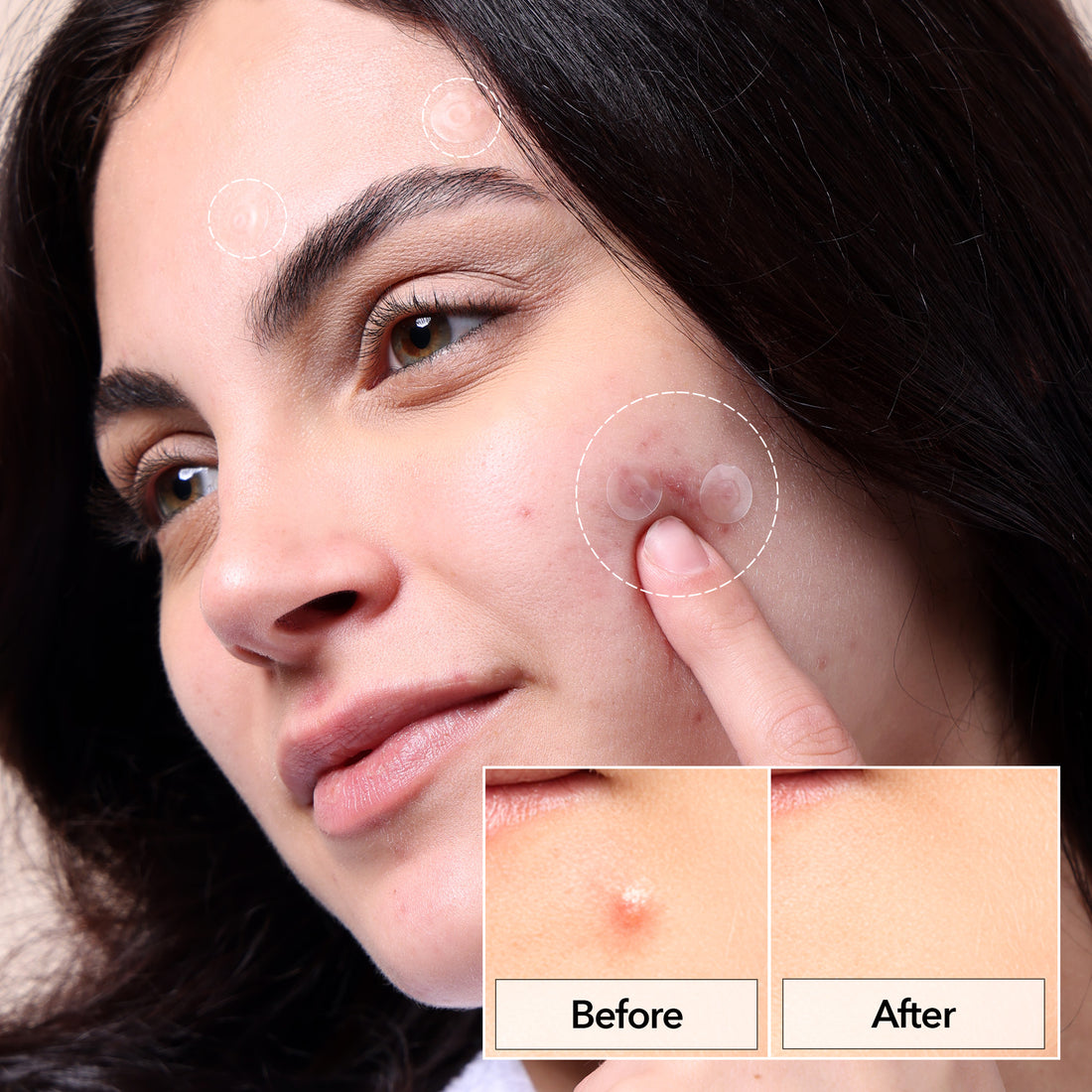 Invisible+ Hydrocolloid Spot Pimple Patch (132 Counts)
