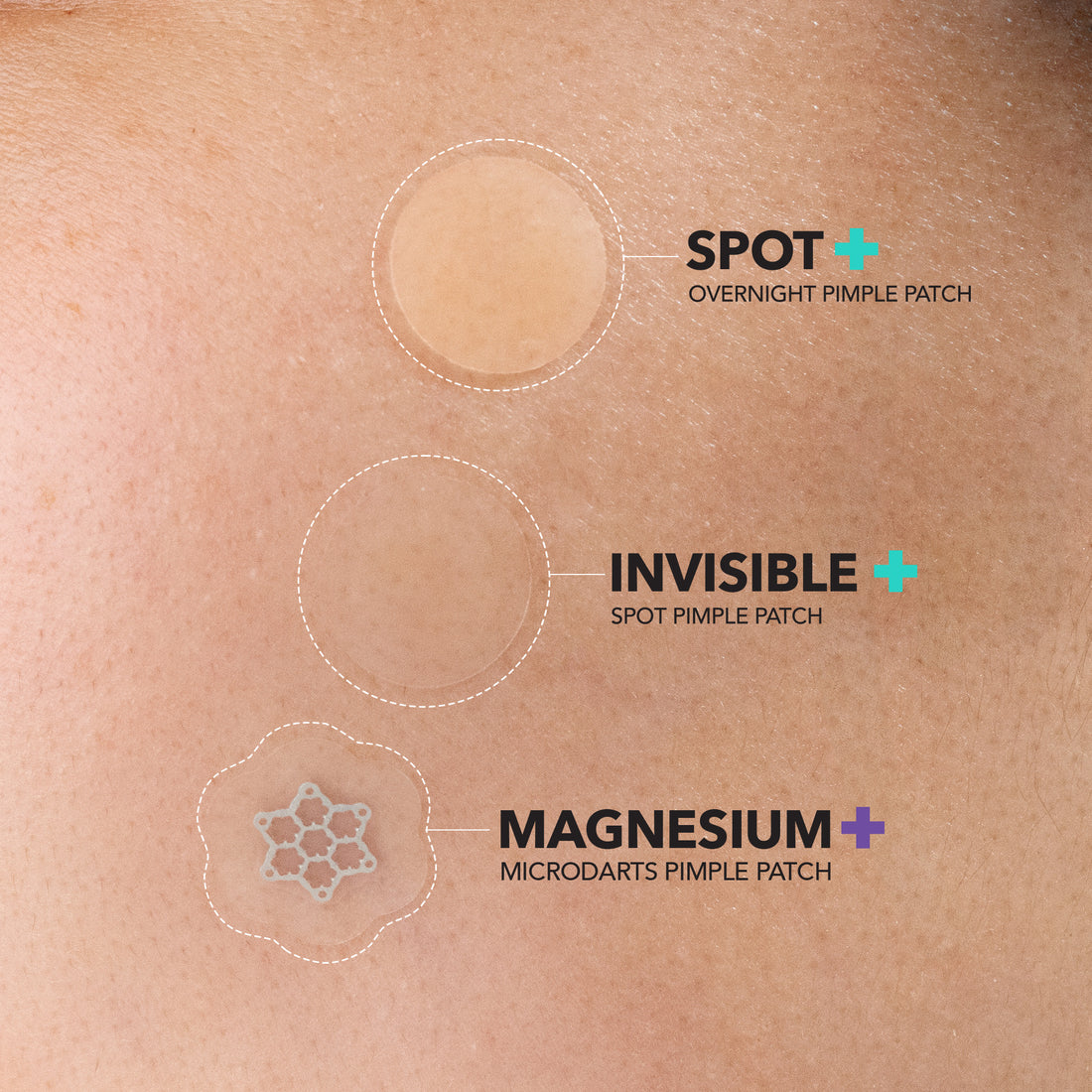 Invisible+ Hydrocolloid Spot Pimple Patch (132 Counts)